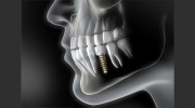 Confidental Dental Surgery