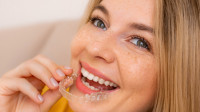 Teeth Straightening