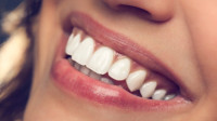 Composite Bonding