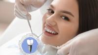 Cost of a single tooth implant UK