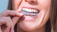 Invisalign London